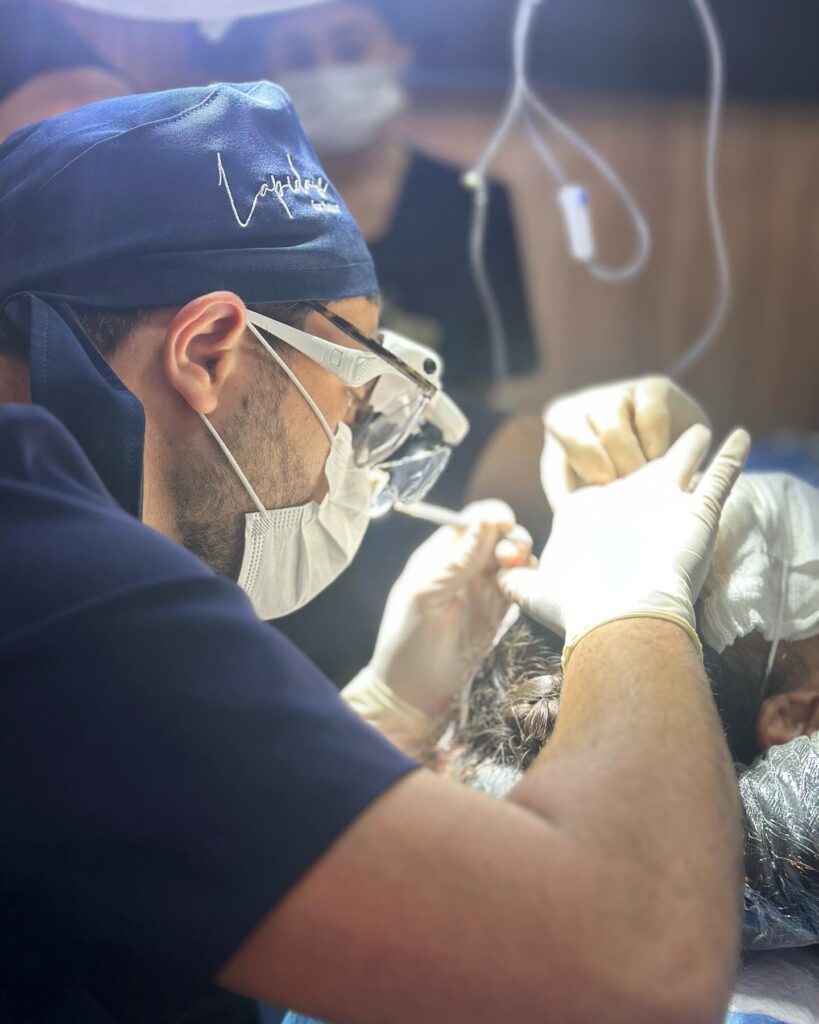 Transplante Capilar FUE - Técnica minimamente invasiva